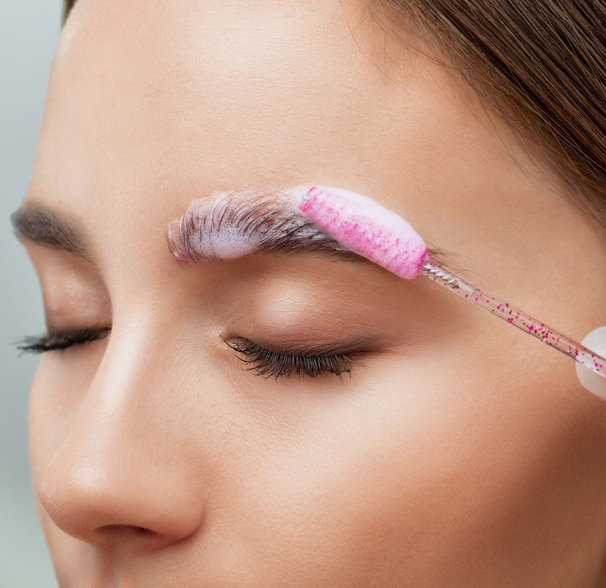 Was ist Wimpernkranzverdichtung?