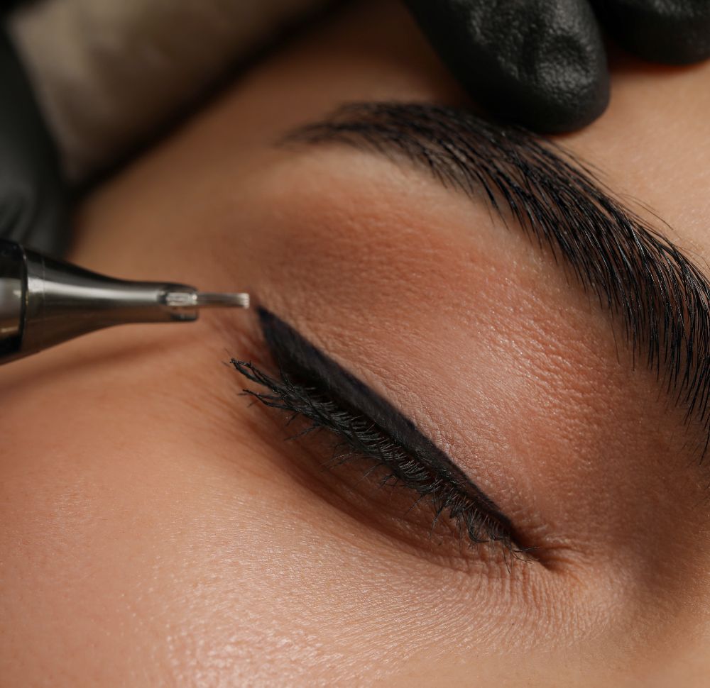 Was ist Wimpernkranzverdichtung?